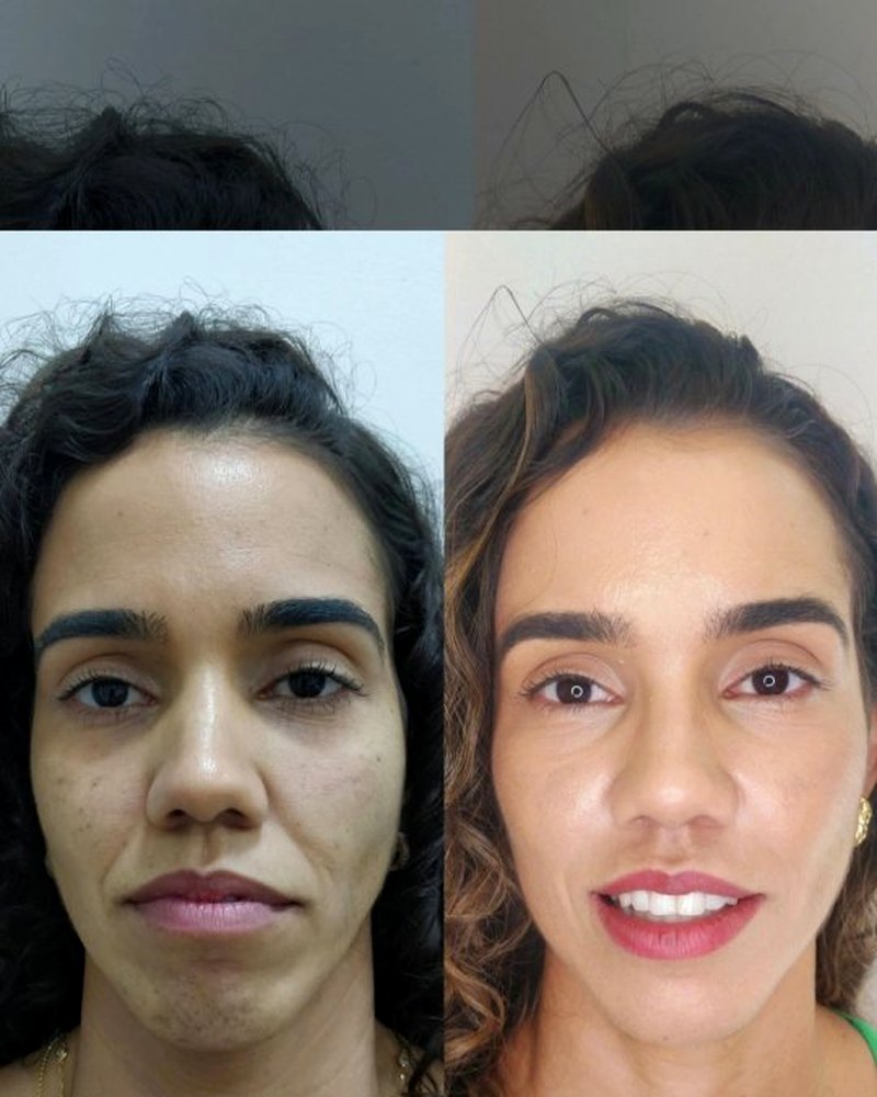 Dra. Maria Alice, cirurgiã-dentista especialista em harmonização facial, em seu consultório na ZĀLE em Santo Antônio de Jesus — BA